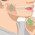 How to temporarily treat TMJ syndrome in the absence of a doctor