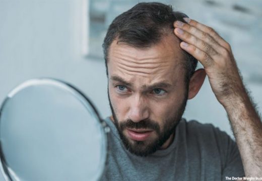 Hair Transplant Options Available for Balding Men