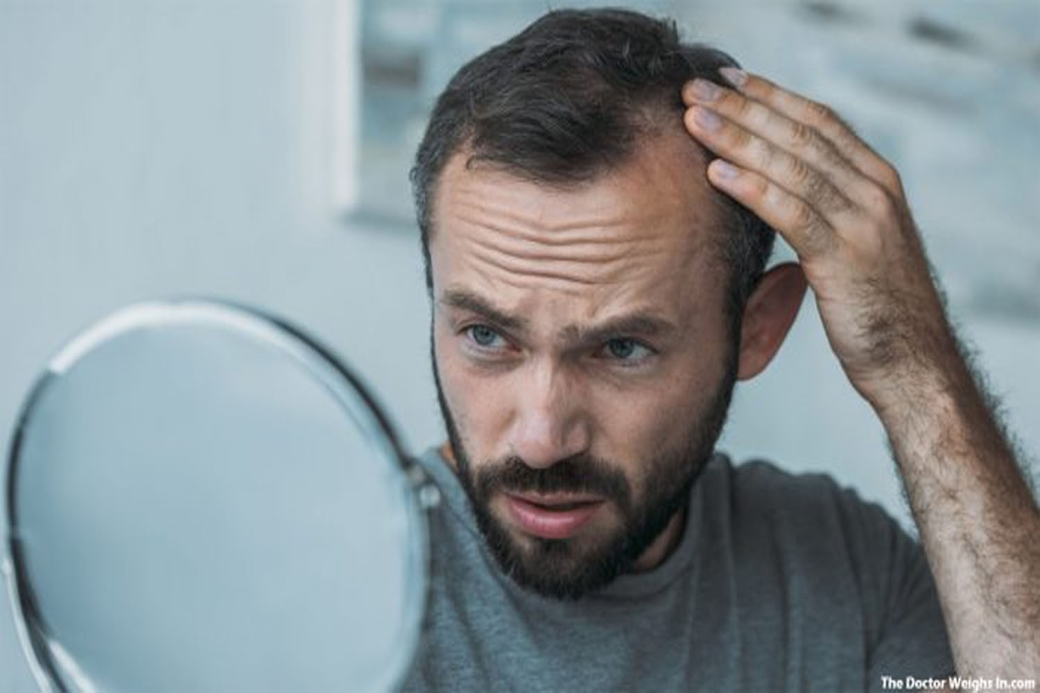 Hair Transplant Options Available for Balding Men