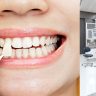 Tips for Choosing The Best Dental Clinic For Your Teeth