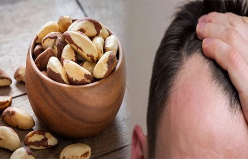 A Diet for Hair Loss for Men With Thinning Hair