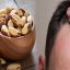 A Diet for Hair Loss for Men With Thinning Hair