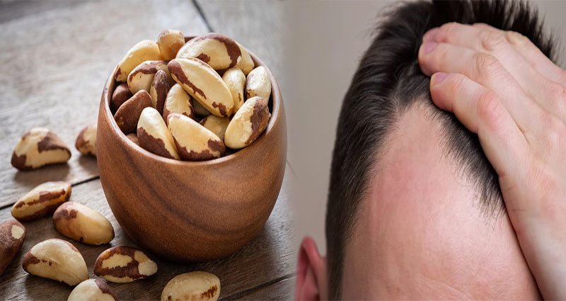 A Diet for Hair Loss for Men With Thinning Hair