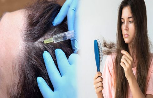 Functional Medicine and Hair Loss