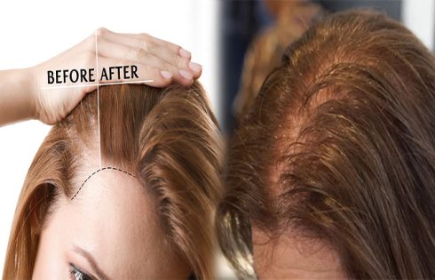 How to Regrow Thinning Female Hair