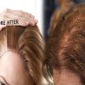 How to Regrow Thinning Female Hair