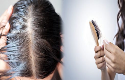 Post Covid Hair Loss Remedy